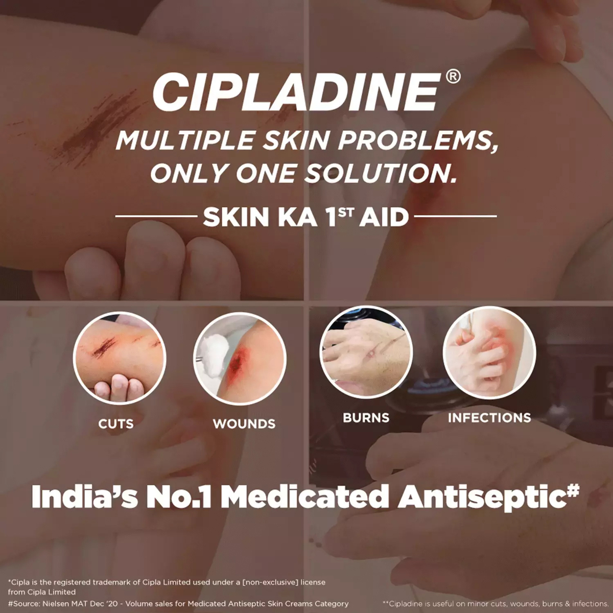Cipladine 10% Ointment 10 gm, Pack of 1 OINTMENT Cipladine 10% Ointment 10 gm, Pack of 1 OINTMENT