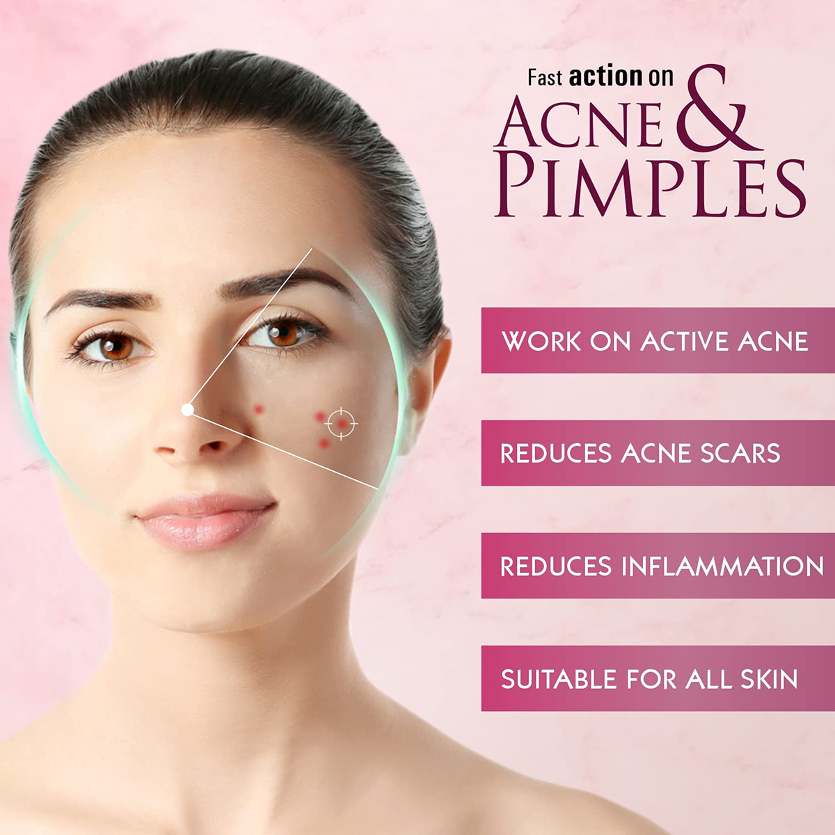 Alite Gel 15 gm, Pack of 1 Alite Gel 15 gm, Pack of 1