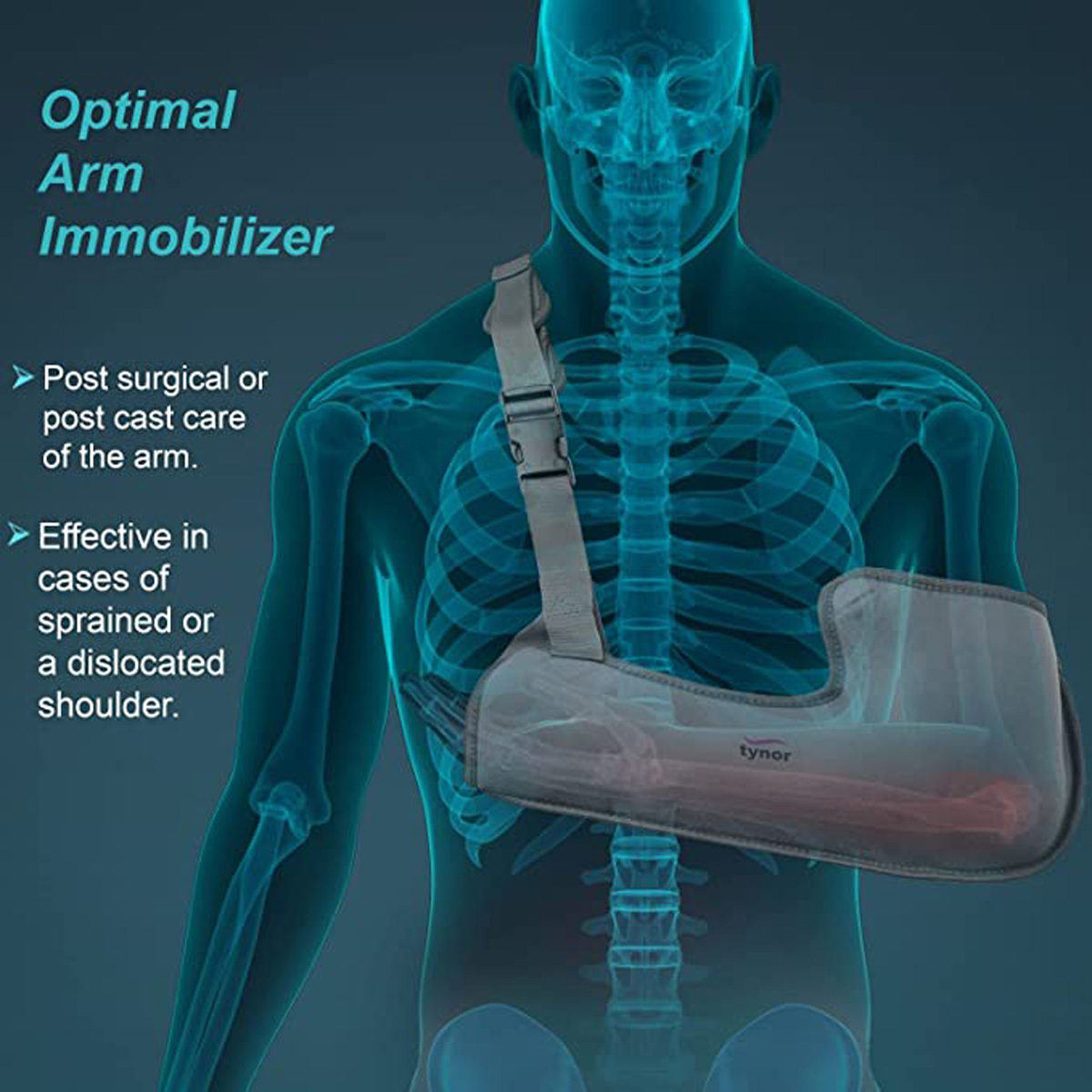 Tynor Arm Sling Pouch Large, 1 Count, Pack of 1 Tynor Arm Sling Pouch Large, 1 Count, Pack of 1