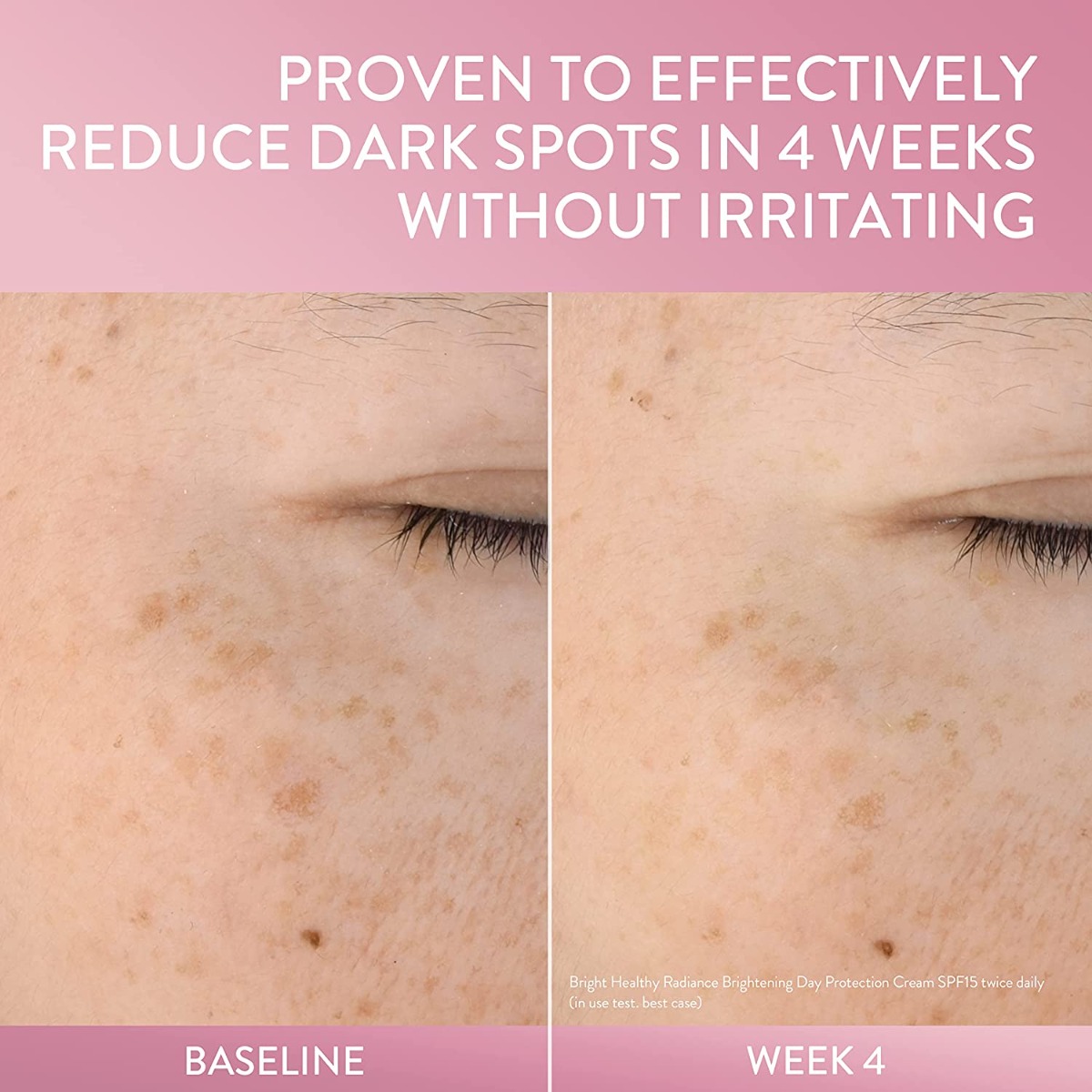 Cetaphil Brightness Refresh Toner 150 ml | Gentle Bright Technology With Natural Sea Daffodil Extract, Niacinamide | Brightens & Illuminates Skin Complexion | Fade Away Dark Spots | Non Sticky | For Sensitive Skin, Pack of 1 Cetaphil Brightness Refresh Toner 150 ml | Gentle Bright Technology With Natural Sea Daffodil Extract, Niacinamide | Brightens & Illuminates Skin Complexion | Fade Away Dark Spots | Non Sticky | For Sensitive Skin, Pack of 1