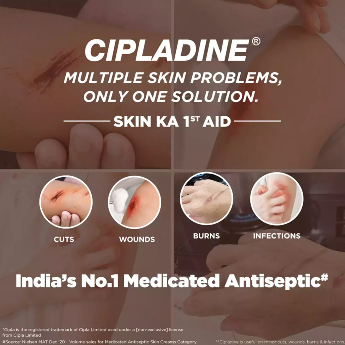 Cipladine 5% Ointment 25 gm, Pack of 1 CREAM Cipladine 5% Ointment 25 gm, Pack of 1 CREAM