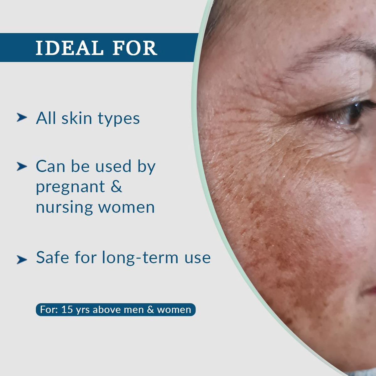 Fixderma Cosmetic Laboratories (FCL) Aha Lightening Gel HQ, 30 ml, Pack of 1 Fixderma Cosmetic Laboratories (FCL) Aha Lightening Gel HQ, 30 ml, Pack of 1