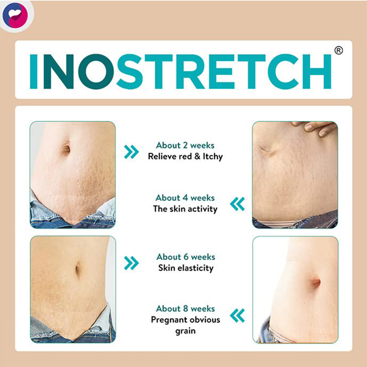 Inostretch Cream 60 gm, Pack of 1 Inostretch Cream 60 gm, Pack of 1