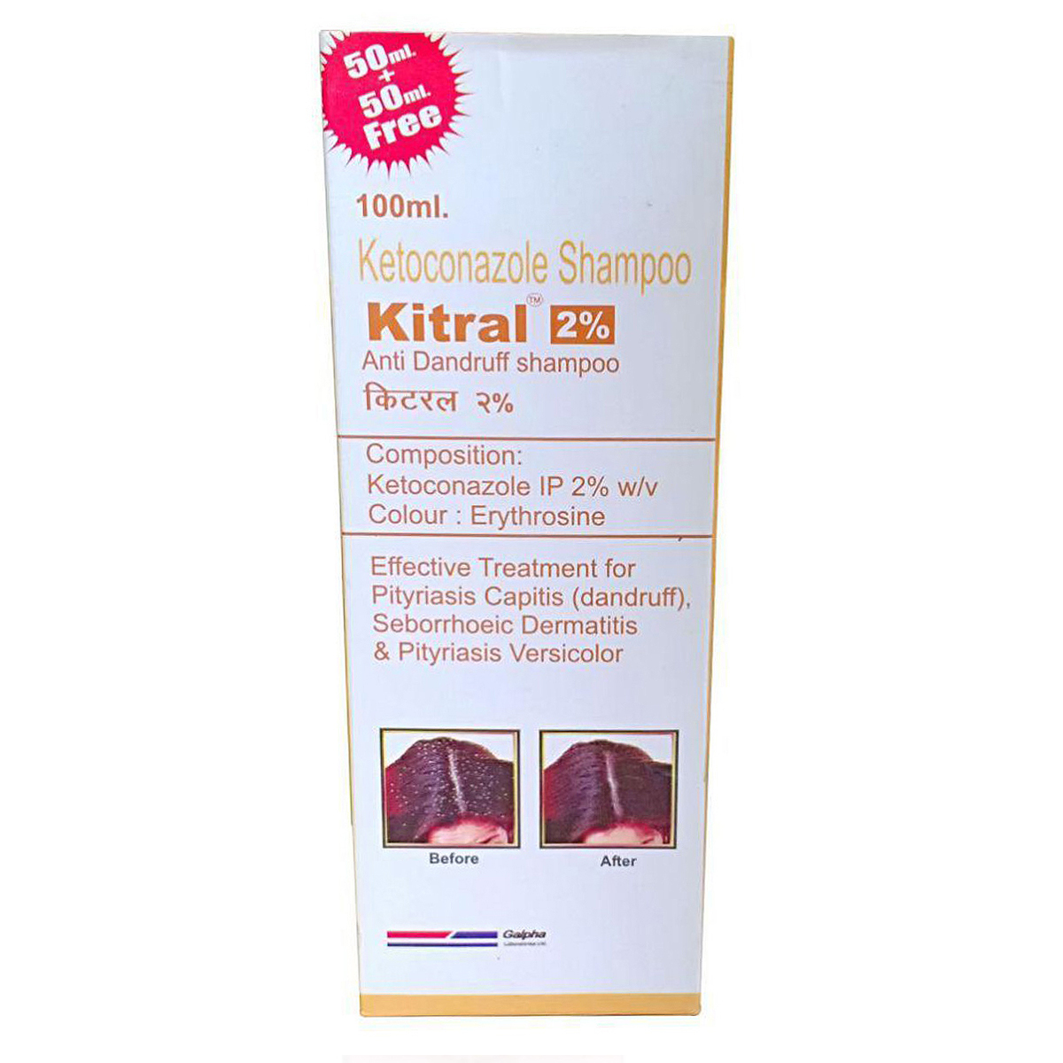 Kitral 2% Anti Dandruff Shampoo, 100 ml, Pack of 1 Kitral 2% Anti Dandruff Shampoo, 100 ml, Pack of 1