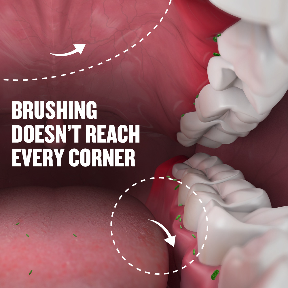 Listerine Freshburst Mouthwash, 250 ml, Pack of 1 Listerine Freshburst Mouthwash, 250 ml, Pack of 1