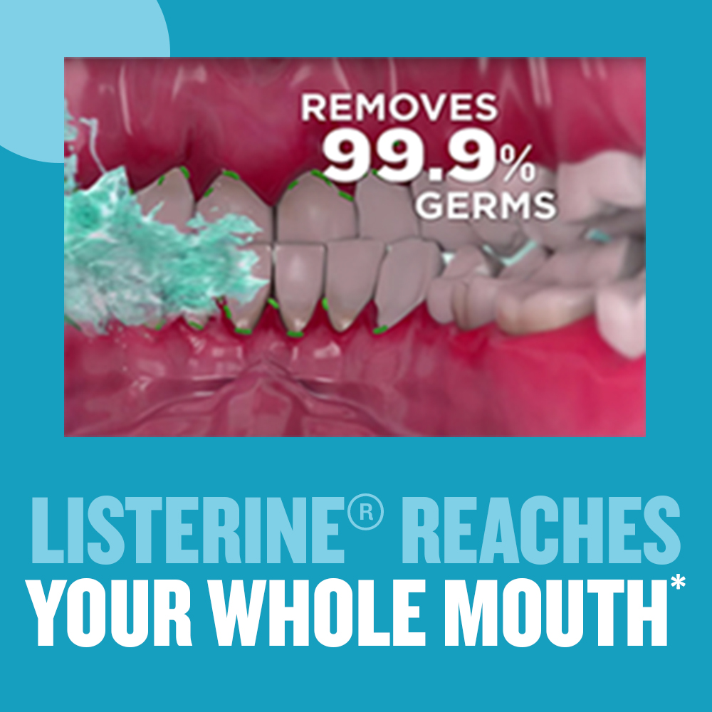 Listerine Freshburst Mouthwash, 250 ml, Pack of 1 Listerine Freshburst Mouthwash, 250 ml, Pack of 1