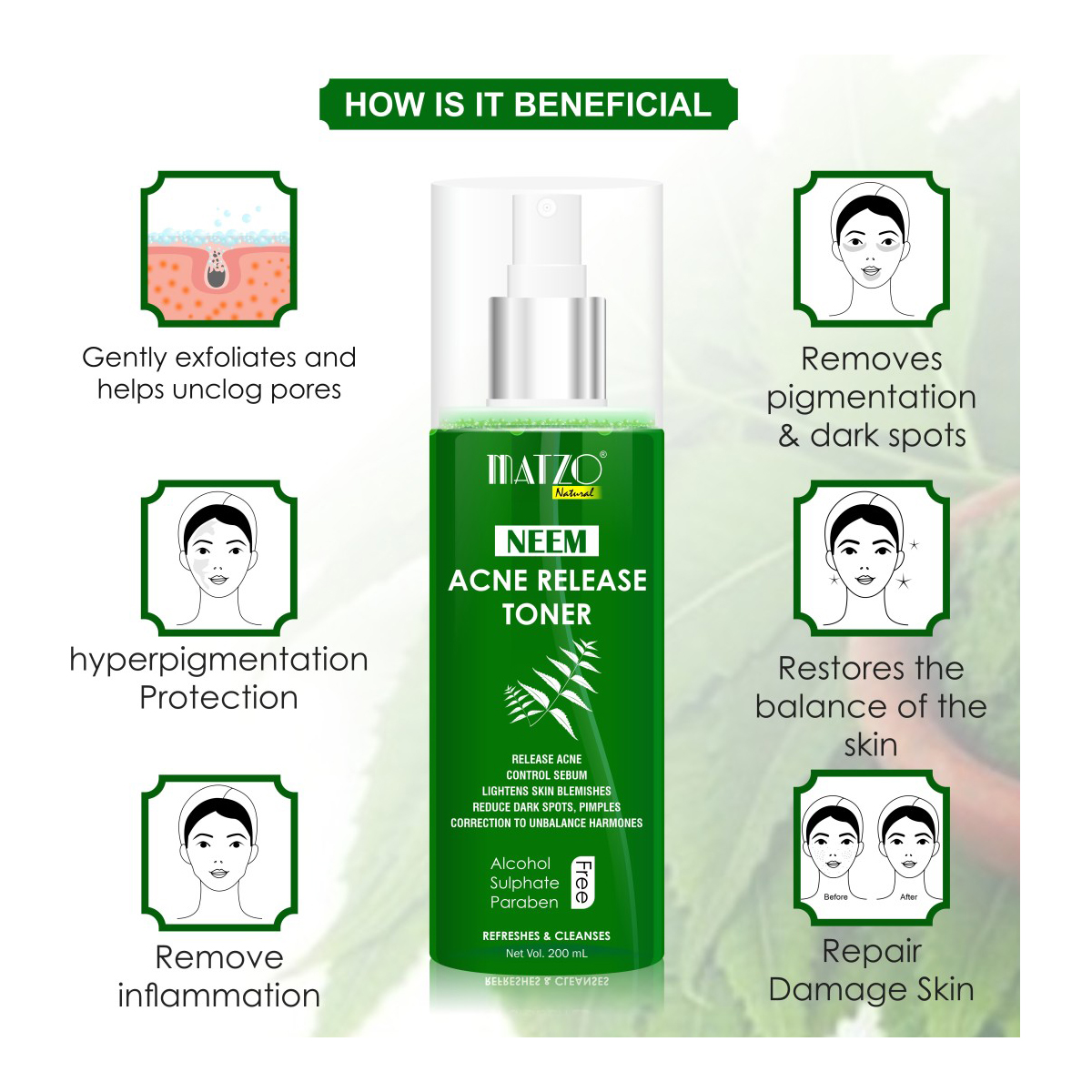 Matzo Neem Acne Release Toner 200 ml | Cleanses & Refreshes | Controls Excess Oil | Reduces Dark Spots, Pimples & Blemishes | 100% Natural | For Men & Women, Pack of 1 Matzo Neem Acne Release Toner 200 ml | Cleanses & Refreshes | Controls Excess Oil | Reduces Dark Spots, Pimples & Blemishes | 100% Natural | For Men & Women, Pack of 1