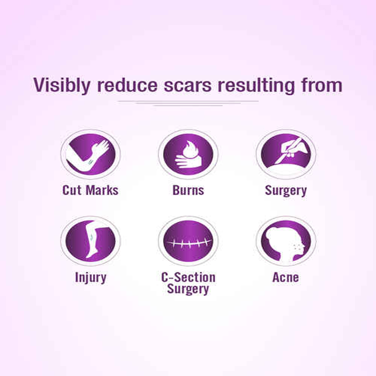 Mederma Cream, 20 gm | With Cepalin & Allantoin | Reduces Scars, Pack of 1 Mederma Cream, 20 gm | With Cepalin & Allantoin | Reduces Scars, Pack of 1