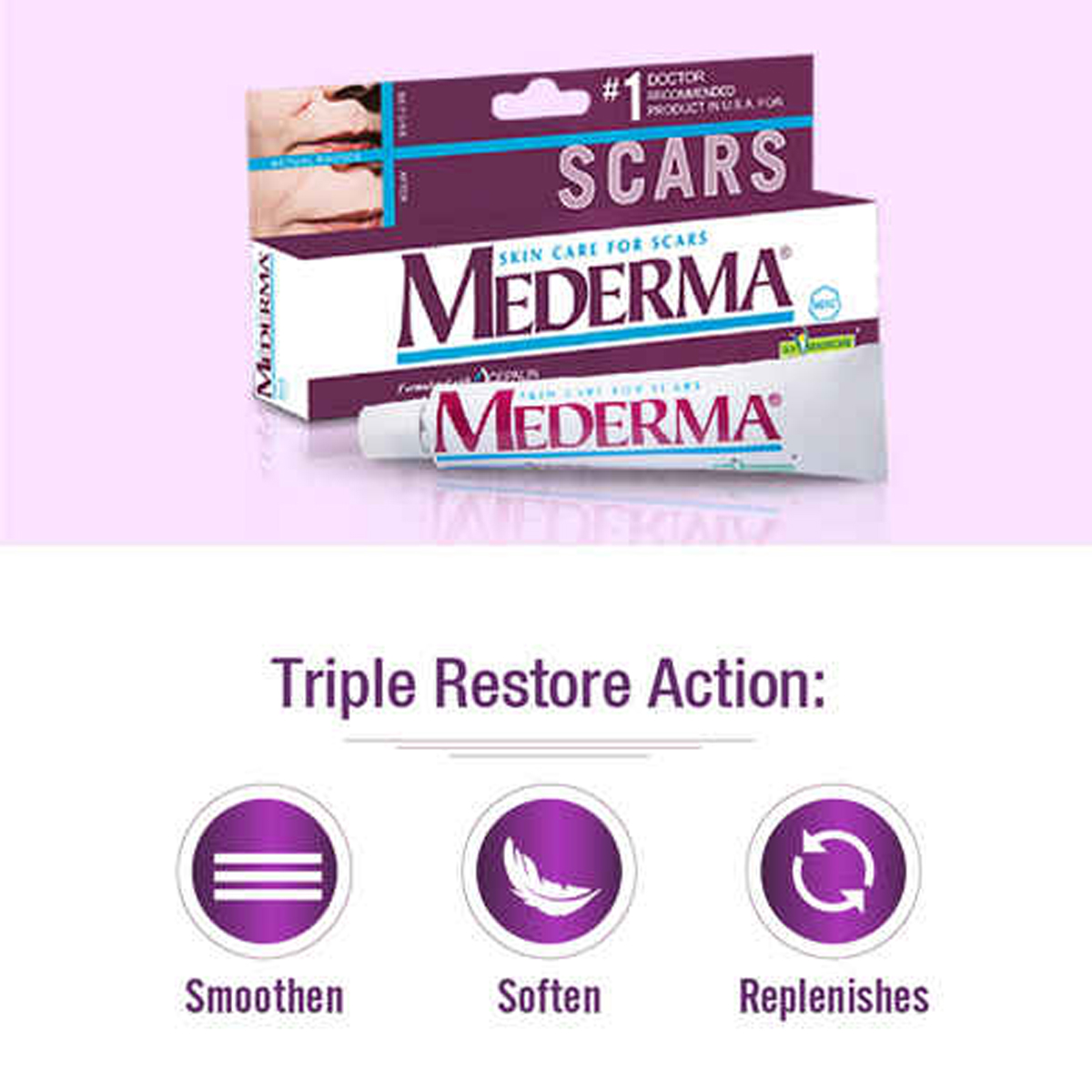 Mederma Cream, 20 gm | With Cepalin & Allantoin | Reduces Scars, Pack of 1 Mederma Cream, 20 gm | With Cepalin & Allantoin | Reduces Scars, Pack of 1