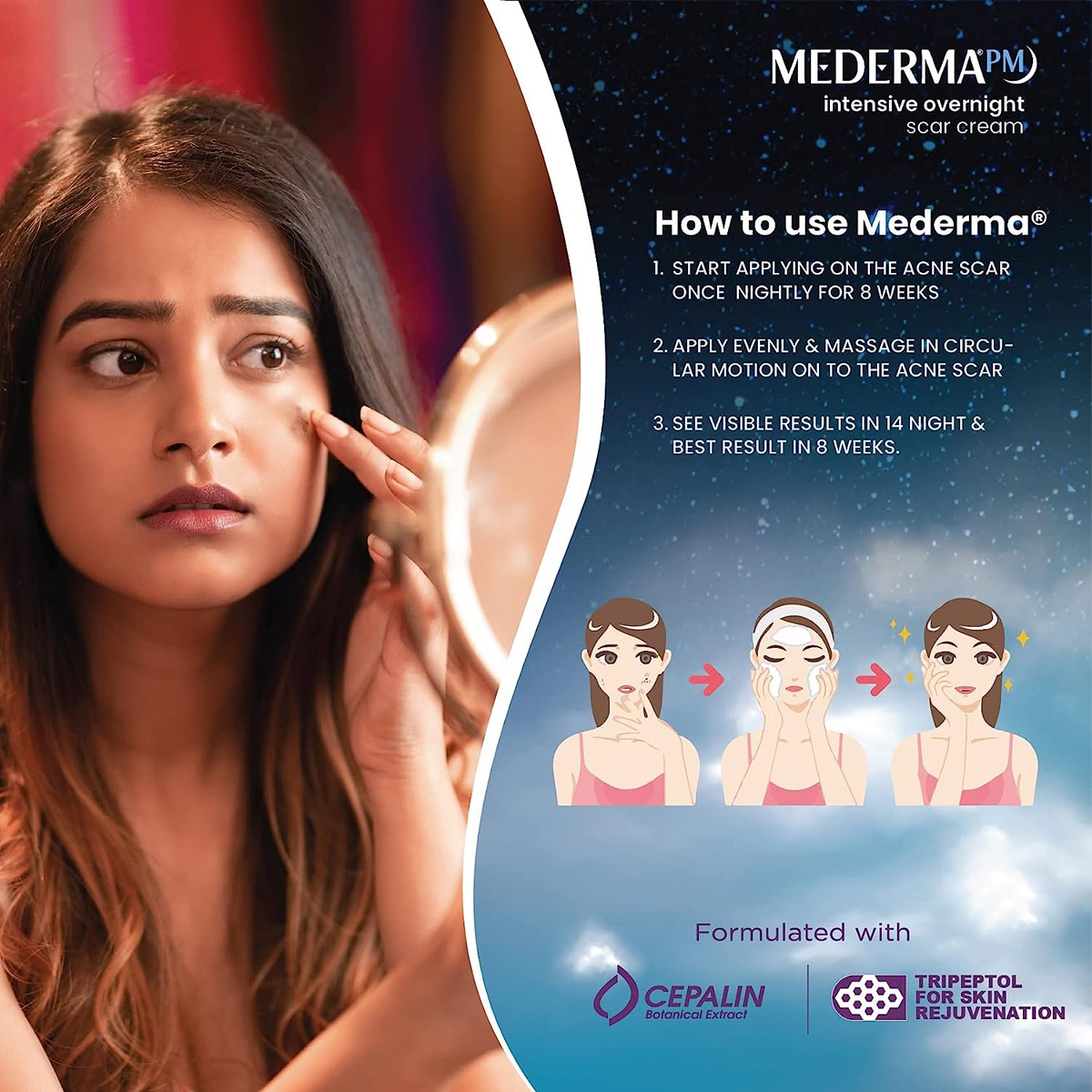 Mederma PM Intensive Overnight Scar Cream 30 gm, Pack of 1 Mederma PM Intensive Overnight Scar Cream 30 gm, Pack of 1