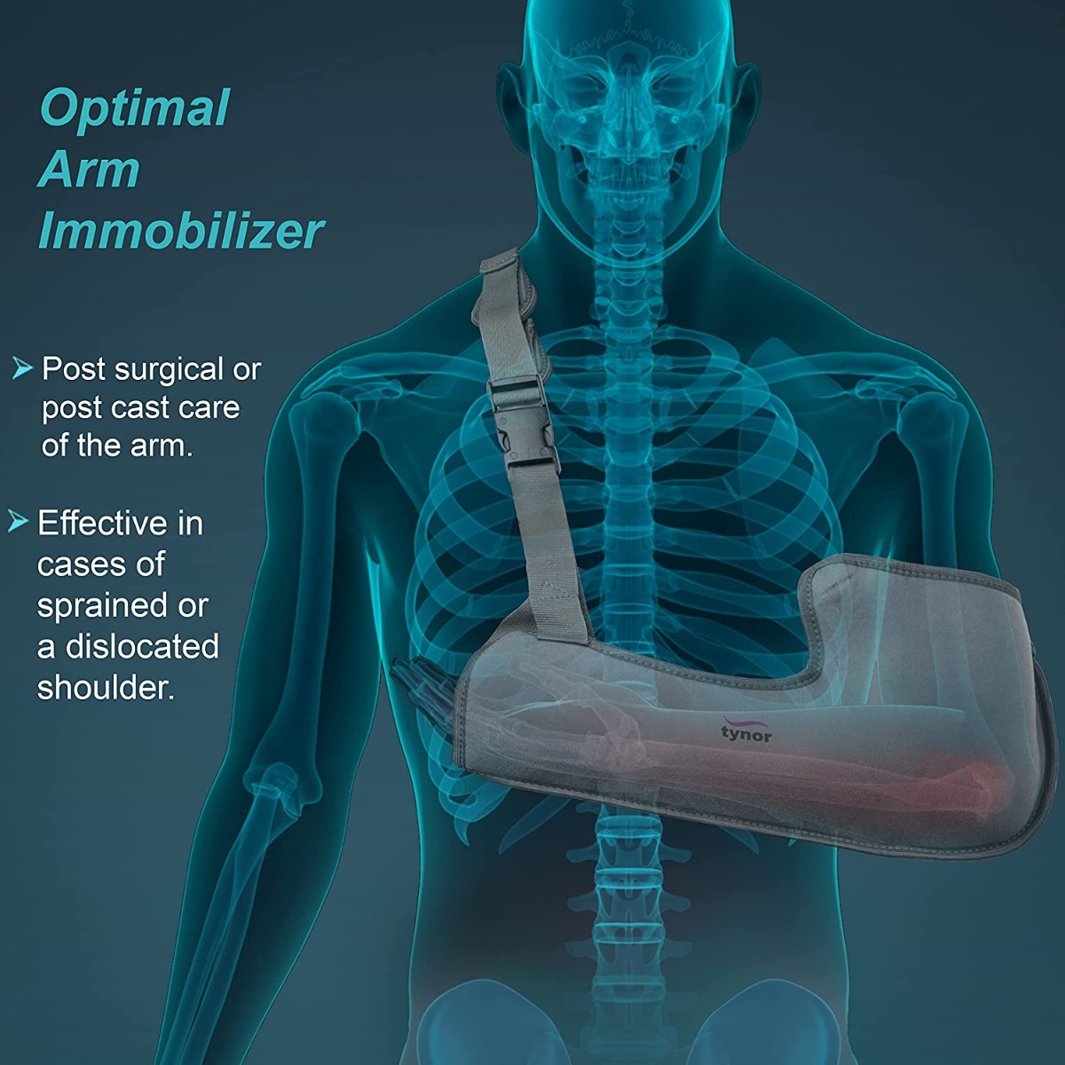 Tynor Arm Sling Tropical Pouch Large, 1 Count, Pack of 1 Tynor Arm Sling Tropical Pouch Large, 1 Count, Pack of 1