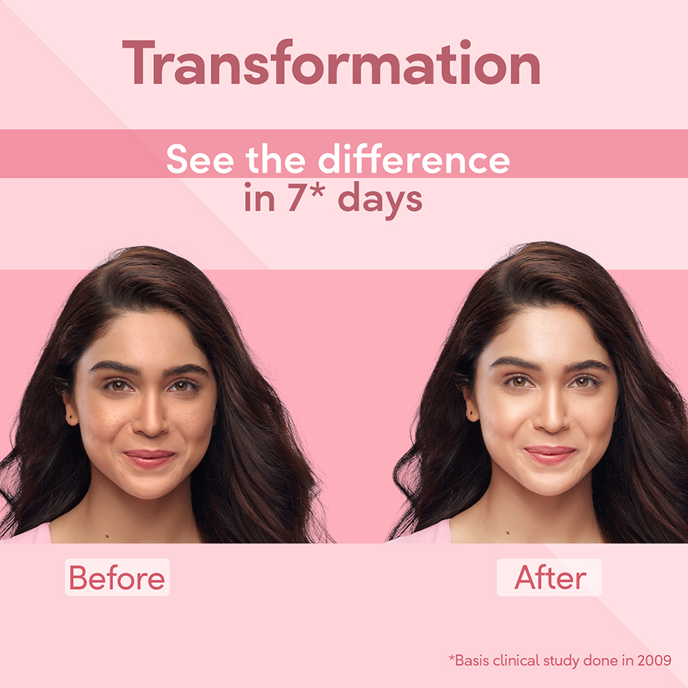 Pond's Bright Beauty SPF15 PA++ Spot-less Day Cream, 50 gm, Pack of 1 Pond's Bright Beauty SPF15 PA++ Spot-less Day Cream, 50 gm, Pack of 1